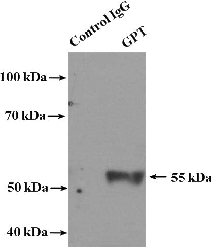 IP Result of anti-GPT (IP:Catalog No:111146, 4ug; Detection:Catalog No:111146 1:500) with L02 cells lysate 1800ug.