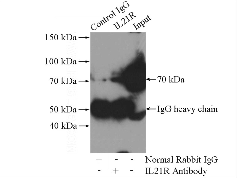 IP Result of anti-IL21R (IP:Catalog No:111778, 4ug; Detection:Catalog No:111778 1:1000) with COLO 320 cells lysate 2000ug.
