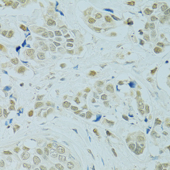 Immunohistochemistry - RCC1 Polyclonal Antibody 