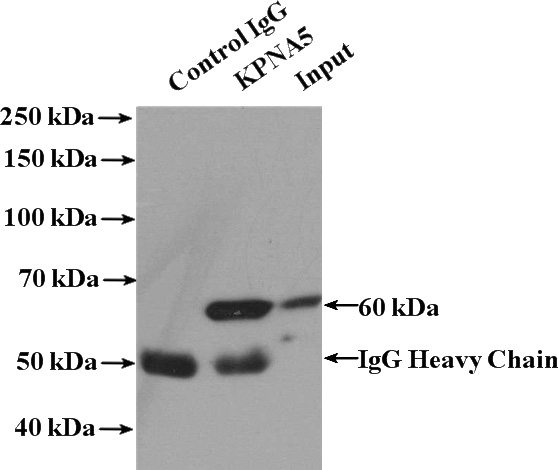 IP Result of anti-KPNA5 (IP:Catalog No:112115, 4ug; Detection:Catalog No:112115 1:2000) with Jurkat cells lysate 4000ug.