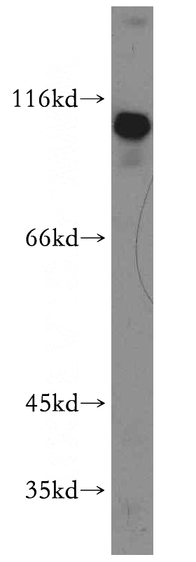 HeLa cells were subjected to SDS PAGE followed by western blot with Catalog No:115110(SENP5-Specific antibody) at dilution of 1:300