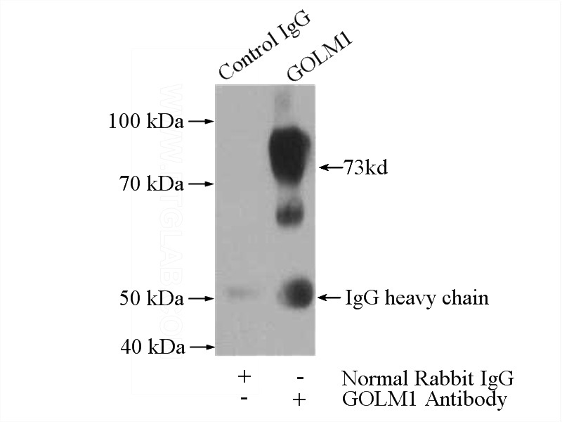 IP Result of anti-GOLM1 (IP:Catalog No:111054, 4ug; Detection:Catalog No:111054 1:1000) with HeLa cells lysate 2800ug.