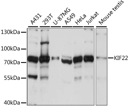 Western blot - KIF22 Polyclonal Antibody 