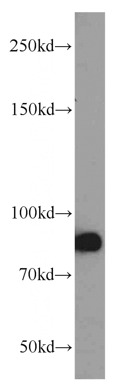 HepG2 cells were subjected to SDS PAGE followed by western blot with Catalog No:109530(CPT1A antibody) at dilution of 1:1000