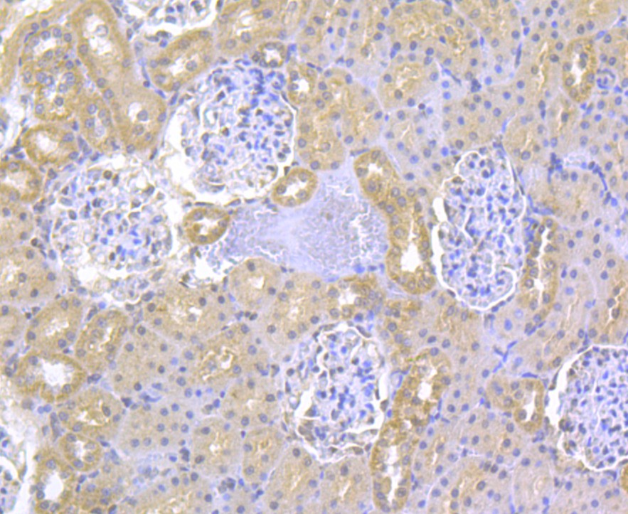 Fig5: Immunohistochemical analysis of paraffin-embedded rat kidney tissue using anti-ITPR2 antibody. Counter stained with hematoxylin.