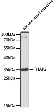 Western blot - THAP2 Polyclonal Antibody 
