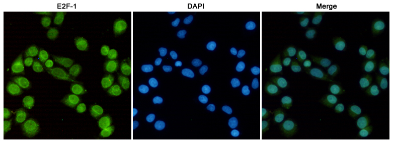 Immunofluorescent analysis of Hela cells fixed with 4% Paraformaldehyde and using anti-E2F-1 mouse mAb (dilution 1:100). DAPI was used to stain nucleus(blue).