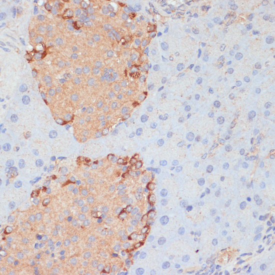 Immunohistochemistry - PTPRN2 Polyclonal Antibody 