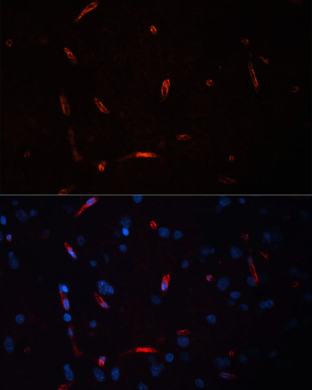 Immunofluorescence - HCRTR1 Polyclonal Antibody 