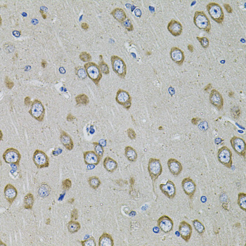 Immunohistochemistry - PDE1B Polyclonal Antibody 