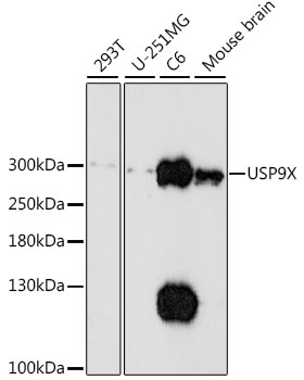Western blot - USP9X Polyclonal Antibody 