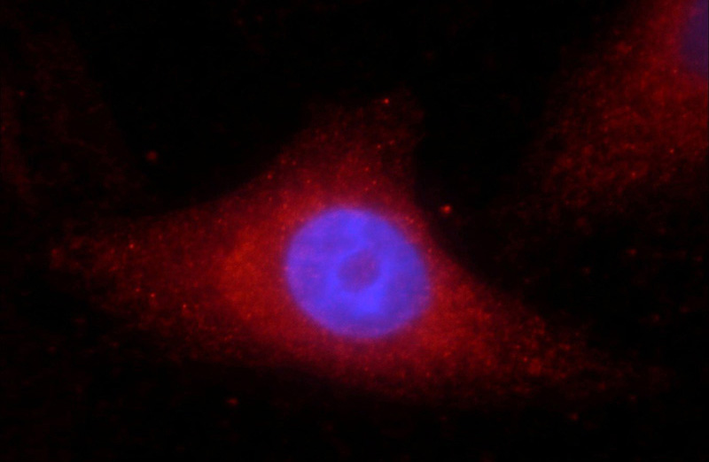 Immunofluorescent analysis of HepG2 cells using Catalog No:108884(Catalase Antibody) at dilution of 1:25 and Rhodamine-Goat anti-Rabbit IgG