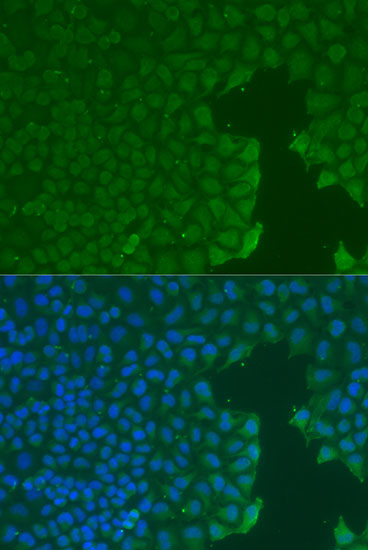 Immunofluorescence - CD31 Polyclonal Antibody 