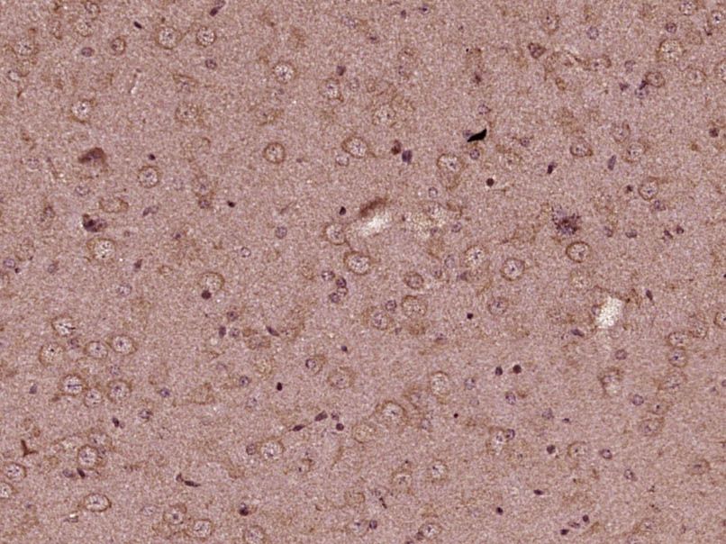 Fig2: Paraformaldehyde-fixed, paraffin embedded (Mouse brain); Antigen retrieval by boiling in sodium citrate buffer (pH6.0) for 15min; Block endogenous peroxidase by 3% hydrogen peroxide for 20 minutes; Blocking buffer (normal goat serum) at 37℃ for 30min; Antibody incubation with (KIF13B) Polyclonal Antibody, Unconjugated at 1:400 overnight at 4℃, followed by operating according to SP Kit(Rabbit) (sp-0023) instructionsand DAB staining.