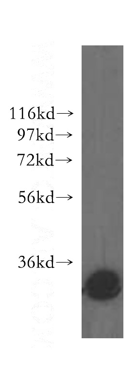 human brain tissue were subjected to SDS PAGE followed by western blot with Catalog No:110834(GALC antibody) at dilution of 1:200