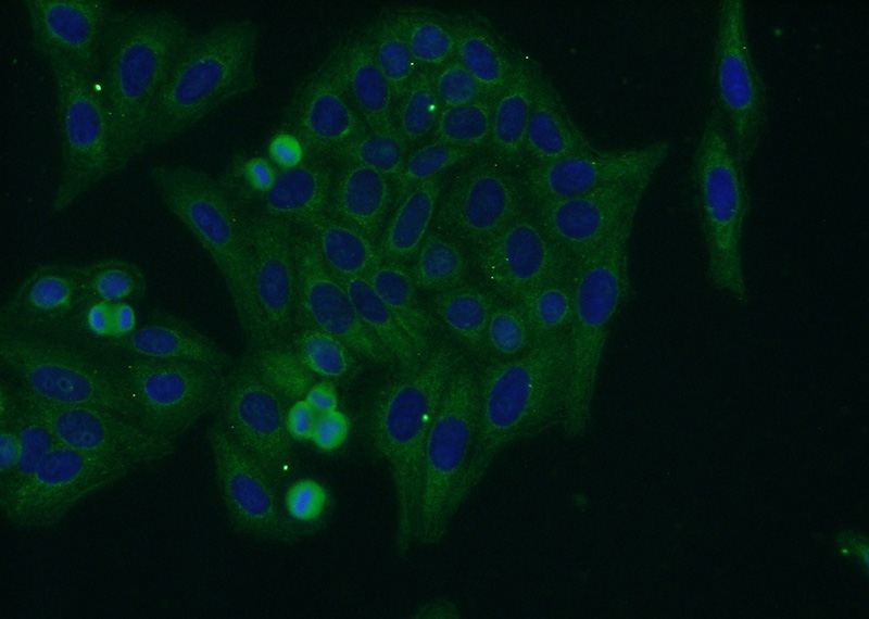 Immunofluorescent analysis of HepG2 cells using Catalog No:110448(FLAD1 Antibody) at dilution of 1:50 and Alexa Fluor 488-congugated AffiniPure Goat Anti-Rabbit IgG(H+L)