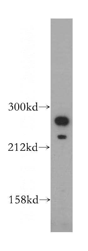 HeLa cells were subjected to SDS PAGE followed by western blot with Catalog No:115845(TLN1 antibody) at dilution of 1:500