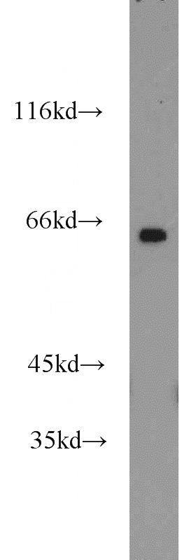 mouse brain tissue were subjected to SDS PAGE followed by western blot with Catalog No:108925(CAMKV antibody) at dilution of 1:1200