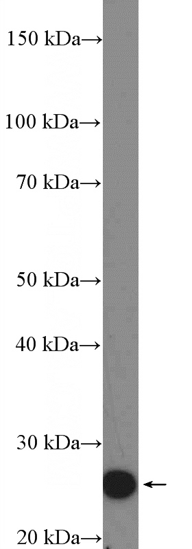 mouse brain tissue were subjected to SDS PAGE followed by western blot with Catalog No:111529(HOXA6 Antibody) at dilution of 1:600