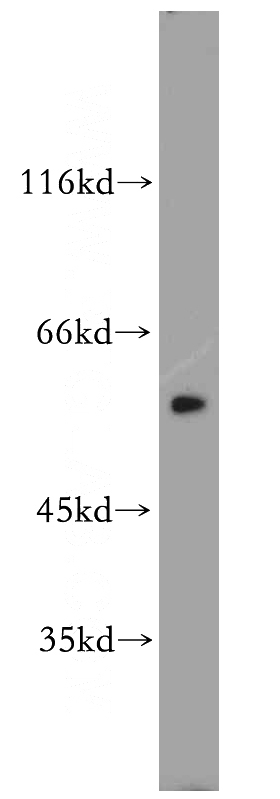 HeLa cells were subjected to SDS PAGE followed by western blot with Catalog No:112904(MUTYH antibody) at dilution of 1:500