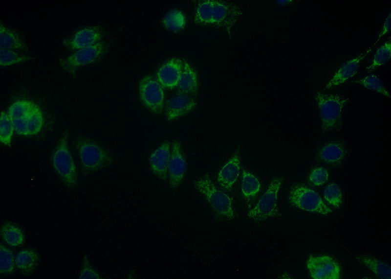 Immunofluorescent analysis of PC-3 cells using Catalog No:114584(RDH11 Antibody) at dilution of 1:25 and Alexa Fluor 488-congugated AffiniPure Goat Anti-Rabbit IgG(H+L)