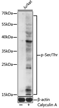 Western blot - Pan Phospho-Ser/Thr pAb 