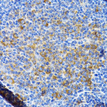 Immunohistochemistry - CHAF1B Polyclonal Antibody 