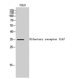 Fig1:; Western Blot analysis of COLO cells using Olfactory receptor 51A7 Polyclonal Antibody