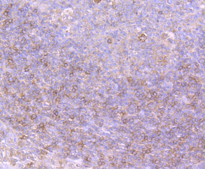 Fig4:; Immunohistochemical analysis of paraffin-embedded human tonsil tissue using anti-Protein Kinase D2 antibody. The section was pre-treated using heat mediated antigen retrieval with Tris-EDTA buffer (pH 8.0-8.4) for 20 minutes.The tissues were blocked in 5% BSA for 30 minutes at room temperature, washed with ddH; 2; O and PBS, and then probed with the primary antibody ( 1/50) for 30 minutes at room temperature. The detection was performed using an HRP conjugated compact polymer system. DAB was used as the chromogen. Tissues were counterstained with hematoxylin and mounted with DPX.