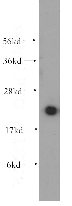 mouse spleen tissue were subjected to SDS PAGE followed by western blot with Catalog No:116509(UBC9 antibody) at dilution of 1:50