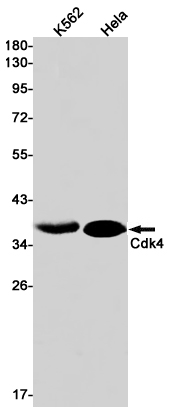 Western blot detection of Cdk4 in K562,Hela cell lysates using Cdk4 Rabbit pAb(1:1000 diluted).Predicted band size:34kDa.Observed band size:34kDa.