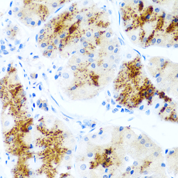 Immunohistochemistry - LAMB3 Polyclonal Antibody 