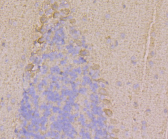 Fig3: Immunohistochemical analysis of paraffin-embedded mouse cerebellum tissue using anti-RYR1 antibody. Counter stained with hematoxylin.