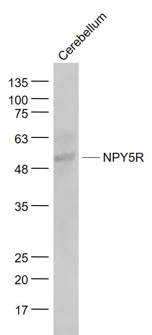 Fig2: Sample:; Cerebellum (Mouse) Lysate at 40 ug; Primary: Anti- NPY5R at 1/1000 dilution; Secondary: IRDye800CW Goat Anti-Rabbit IgG at 1/20000 dilution; Predicted band size: 51 kD; Observed band size: 53 kD