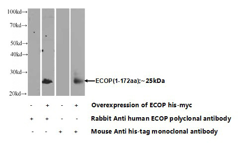 Transfected HEK-293 cells were subjected to SDS PAGE followed by western blot with Catalog No:110296(ECOP Antibody) at dilution of 1:1000