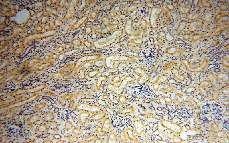 Immunohistochemical of paraffin-embedded human kidney using Catalog No:112267(LAD1 antibody) at dilution of 1:100 (under 10x lens)