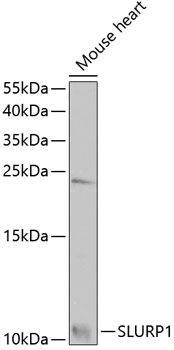 Western blot - SLURP1 Polyclonal Antibody 