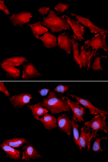 Immunofluorescence - CTNND1 Polyclonal Antibody 
