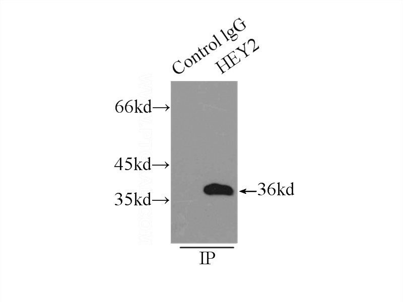 IP Result of anti-HEY2 (IP:Catalog No:111309, 5ug; Detection:Catalog No:111309 1:500) with mouse heart tissue lysate 7500ug.