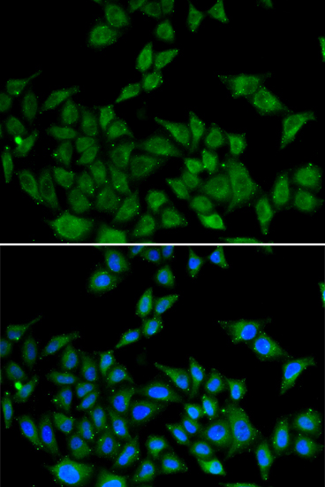 Immunofluorescence - DIDO1 Polyclonal Antibody 