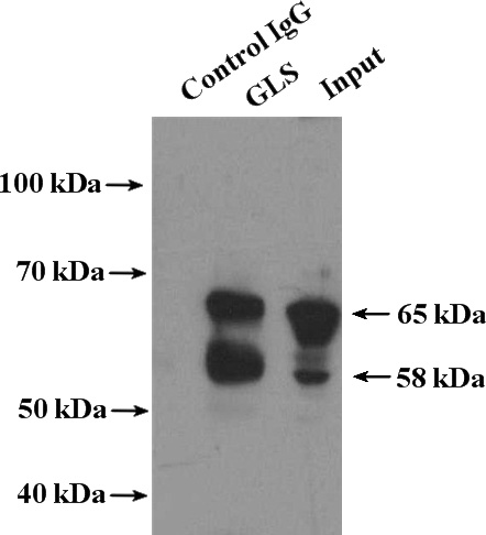 IP Result of anti-GLS (IP:Catalog No:112034, 4ug; Detection:Catalog No:112034 1:1000) with HEK-293 cells lysate 1200ug.
