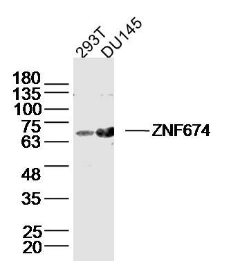 Fig1: Sample:; 293T Cell (Human) Lysate at 40 ug; DU145 Cell (Human) Lysate at 40 ug; Primary: Anti-ZNF674 at 1/300 dilution; Secondary: IRDye800CW Goat Anti-Rabbit IgG at 1/20000 dilution; Predicted band size: 67 kD; Observed band size: 67 kD
