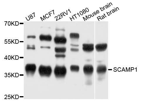 Western blot - SCAMP1 Polyclonal Antibody 