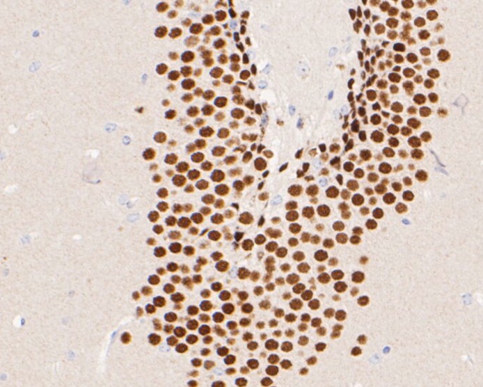 Fig2: Immunohistochemical analysis of paraffin-embedded mouse brain tissue using anti-NeuroD2 antibody. The section was pre-treated using heat mediated antigen retrieval with sodium citrate buffer (pH 6.0) for 20 minutes. The tissues were blocked in 5% BSA for 30 minutes at room temperature, washed with ddH2O and PBS, and then probed with the primary antibody ( 1/50) for 30 minutes at room temperature. The detection was performed using an HRP conjugated compact polymer system. DAB was used as the chromogen. Tissues were counterstained with hematoxylin and mounted with DPX.