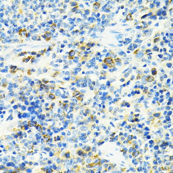 Immunohistochemistry - SLC25A11 Polyclonal Antibody 