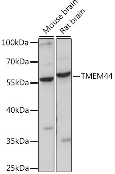 Western blot - TMEM44 Polyclonal Antibody 