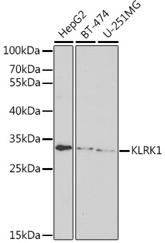 Western blot - KLRK1 Polyclonal Antibody 