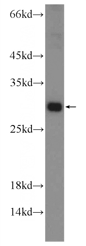 mouse testis tissue were subjected to SDS PAGE followed by western blot with Catalog No:108621(C19orf36 Antibody) at dilution of 1:600