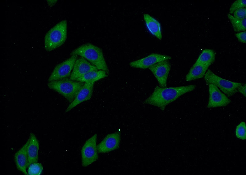 Immunofluorescent analysis of HepG2 cells using Catalog No:107961(ALDH1A3 Antibody) at dilution of 1:50 and Alexa Fluor 488-congugated AffiniPure Goat Anti-Rabbit IgG(H+L)