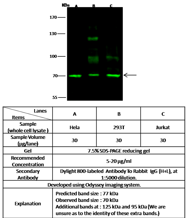 SCML2 Antibody, Rabbit PAb, Antigen Affinity Purified, Western blot